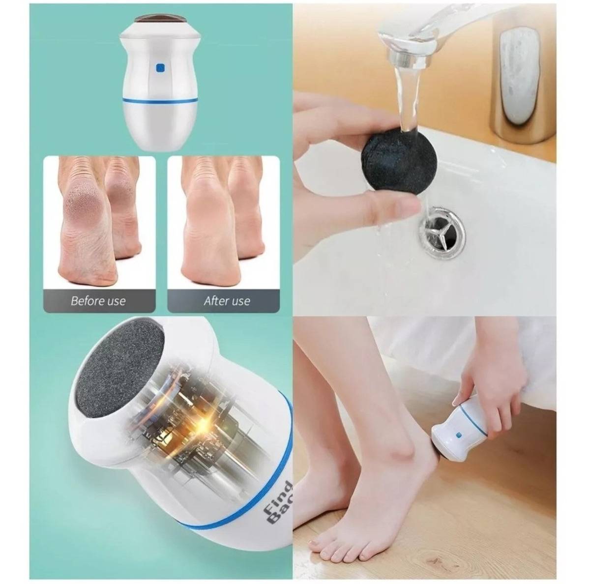 Removedor de Callos Portátil